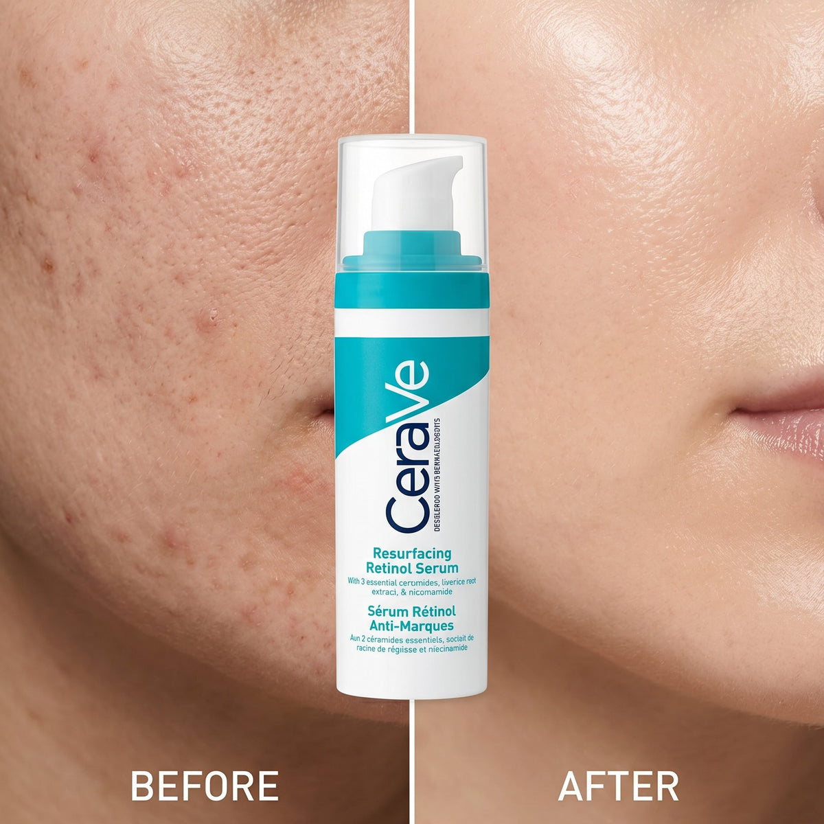 CeraVe Sérum Retinol Anti-Manchas 30ml | Piel Más Luminosa y Uniforme