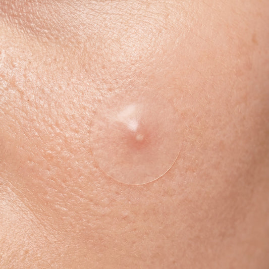 Garnier Parches Anti-Granitos Invisibles x22 | Acné e Imperfecciones